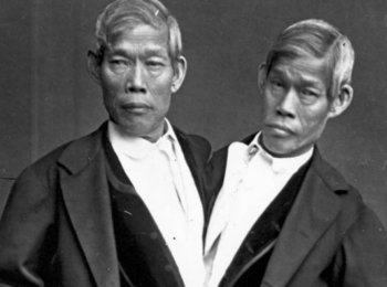 L'histoire vraie et bouleversante des premiers frères siamois
